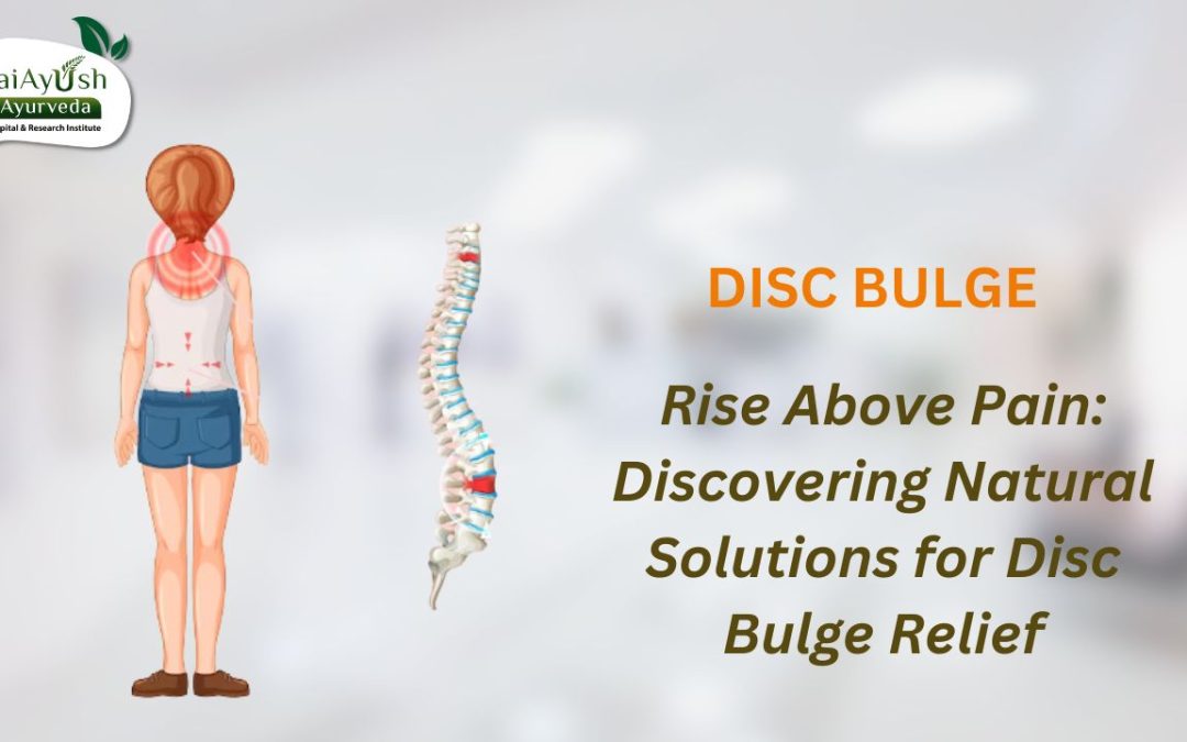 Say Goodbye to Disc Bulge with Ayurvedic Treatment: The Best Way to Heal Naturally
