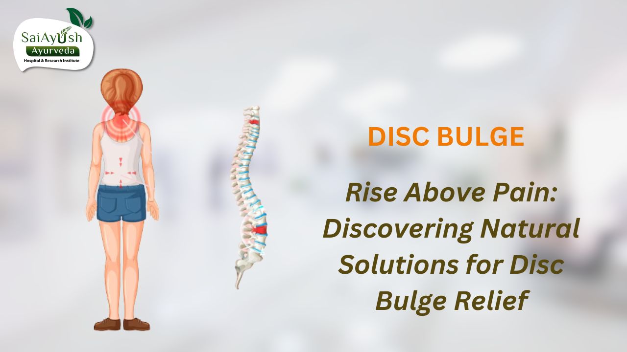 disc bulge