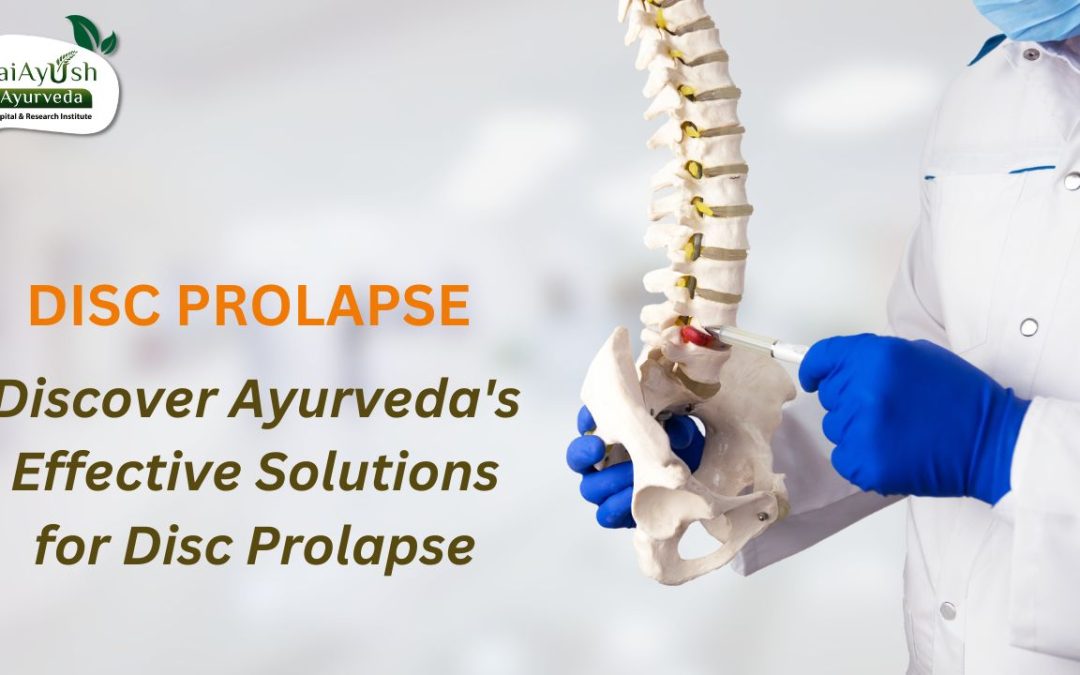Disc Prolapse: The Ayurvedic Approach to Understanding, Managing, and Reversing It