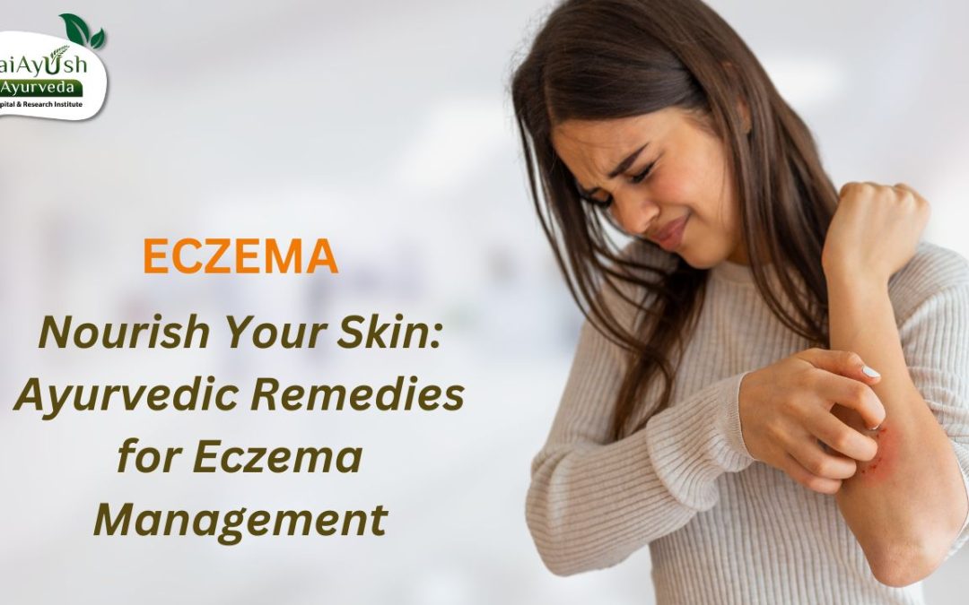 Embracing Ayurveda for Eczema: Understanding, Managing, and Thriving