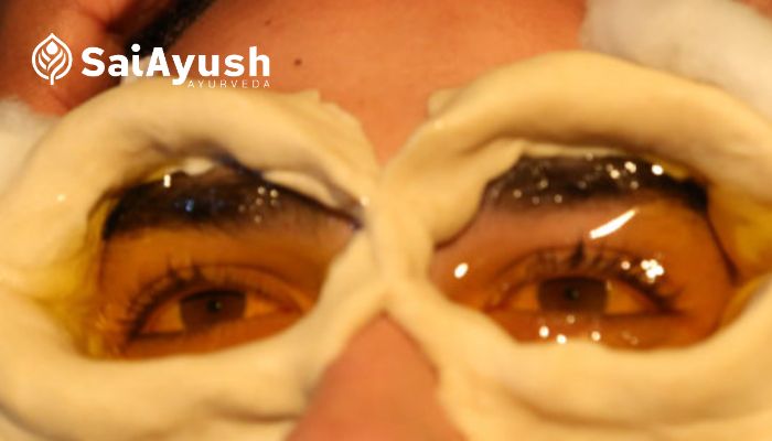 ayurvedic eye treatment