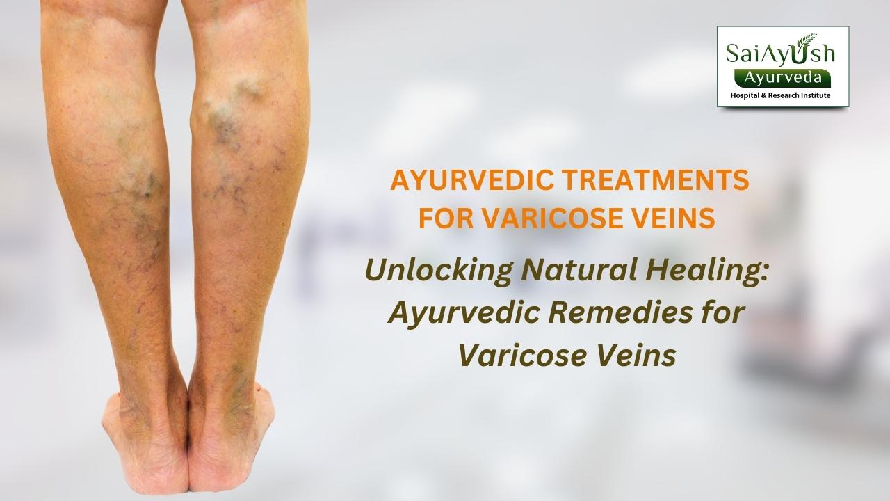 Adopting Ayurveda: A Comprehensive Method for Treating Varicose Venous Diseases