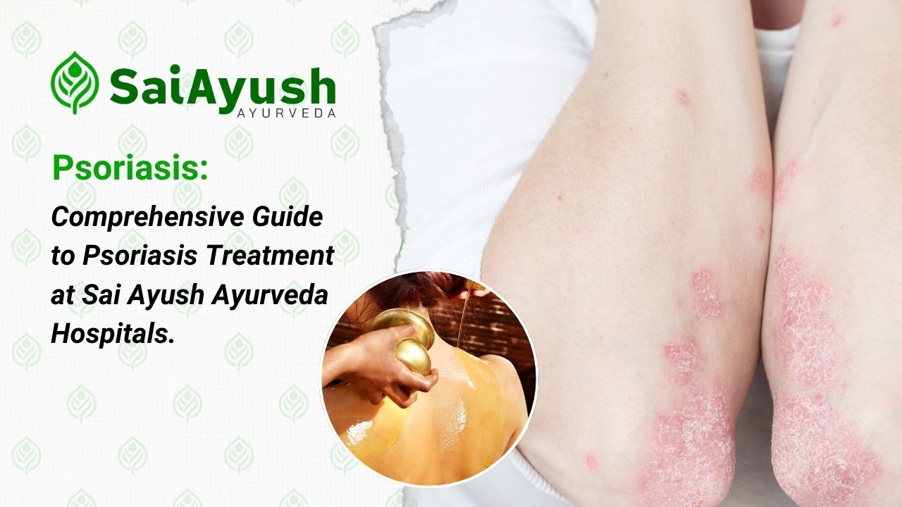 Psoriasis Treatment at Sai Ayush Ayurveda 1