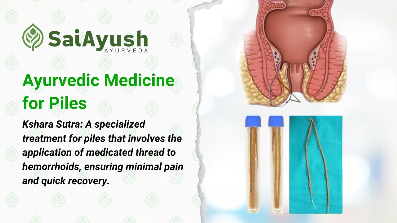 Ayurvedic Medicine for Piles