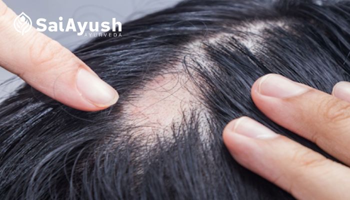 ayurvedic treatment for hair loss and regrowth